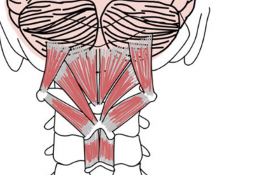 Tratamiento quiropractico para dolor de cabeza